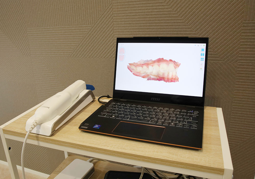 口腔内スキャナー
